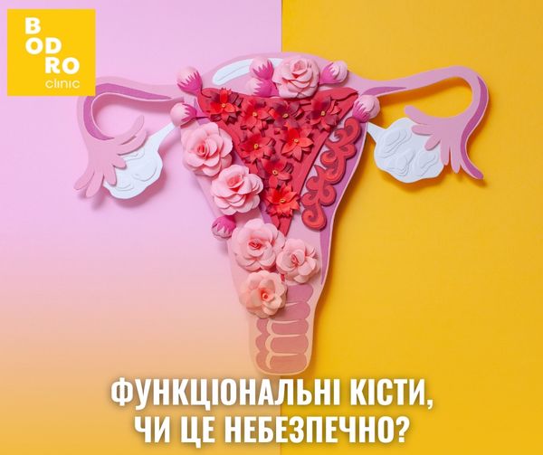 Функціональні кісти