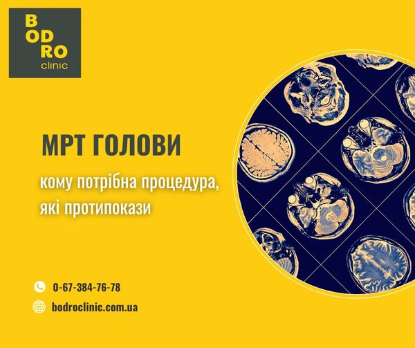 Магнітно-резонансна томографія голови